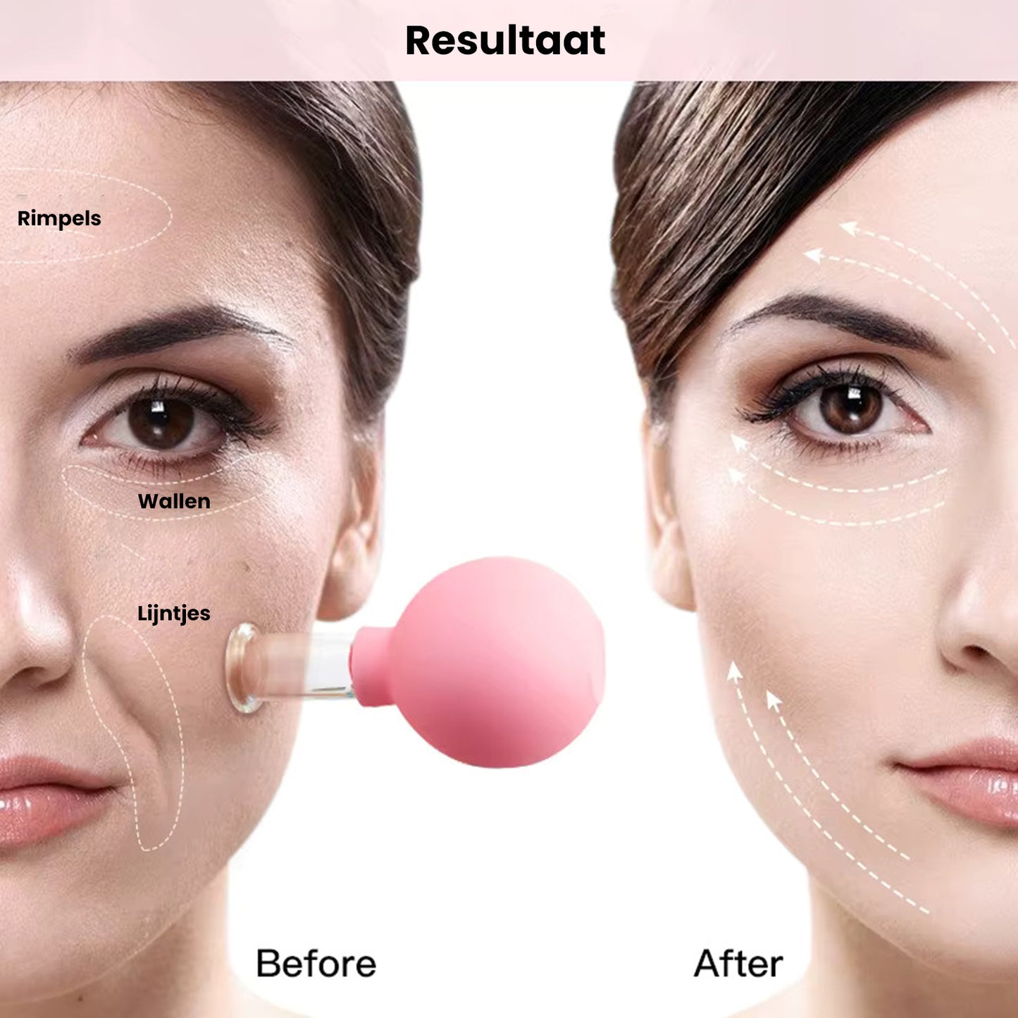 Skin Revival Cupping sæt